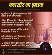 बवासीर के 52 सबसे अचूक घरेलू उपचार | piles treatment in hindi
