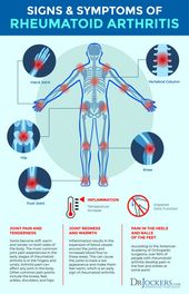 Rheumatoid Arthritis: Symptoms, Causes and Natural Support Strategies
