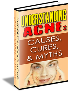 Understanding Acne Causes Cures and Myths