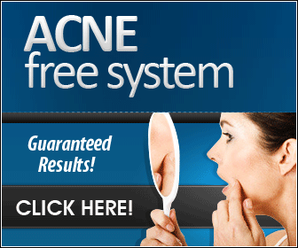 Acne Free System