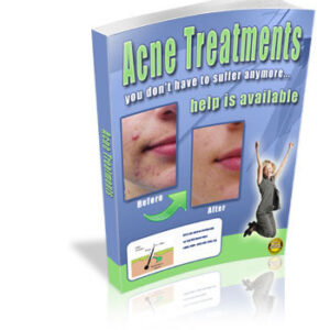 Acne Treatments